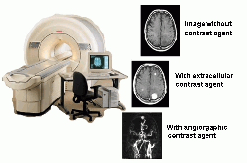 MRI Contrast Agents Clinical Applications 