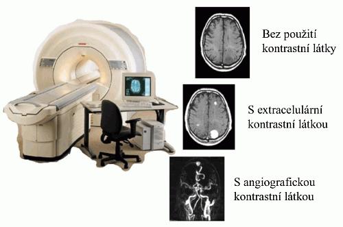 MRI