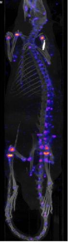 PET (Positron Emission Tomography)