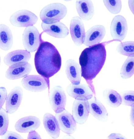 Leucocytozoon in buzzard blood