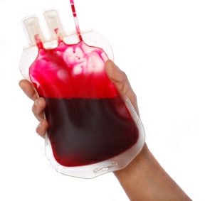 obr.1 - krevn transfuze
